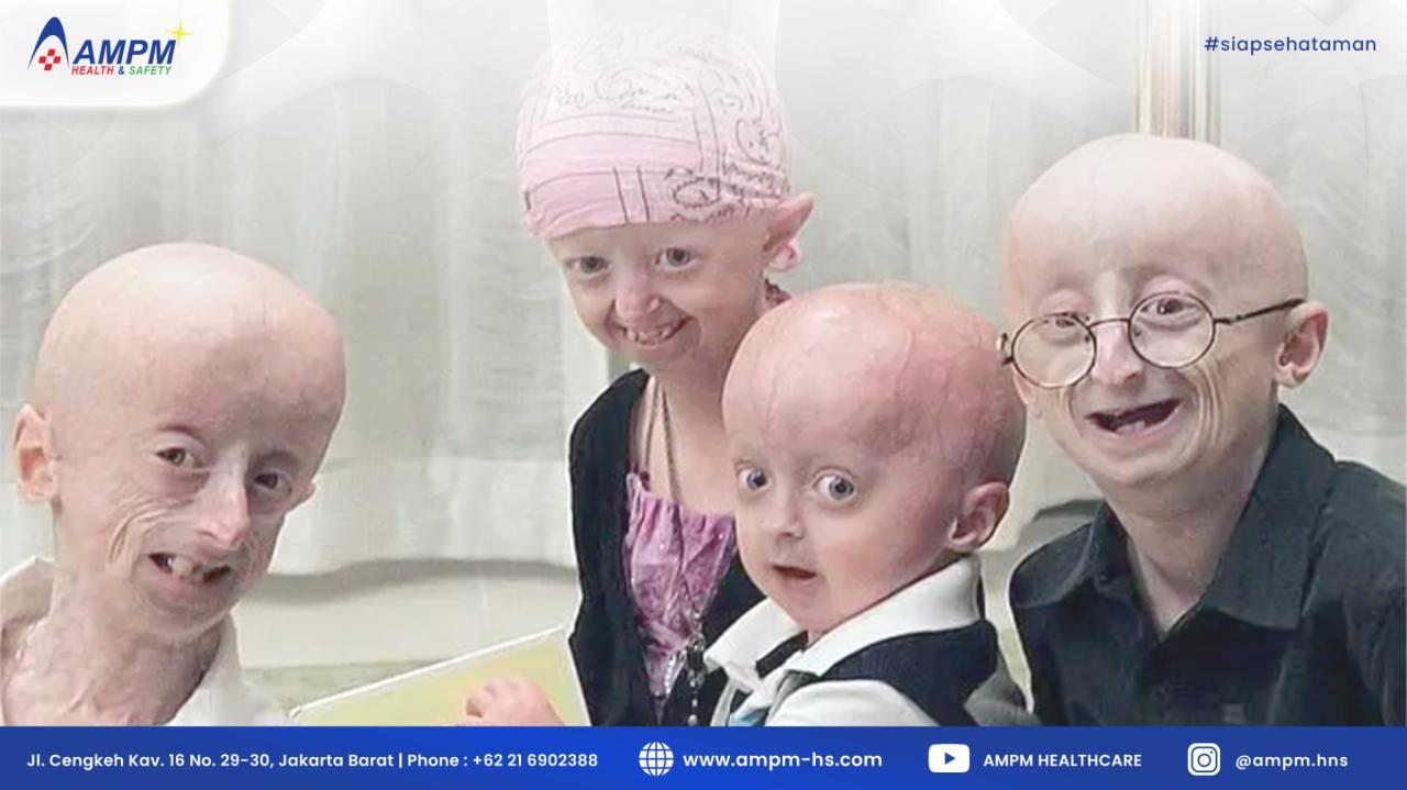 Informasi Terbaru Tentang Penelitian Penyakit Langka