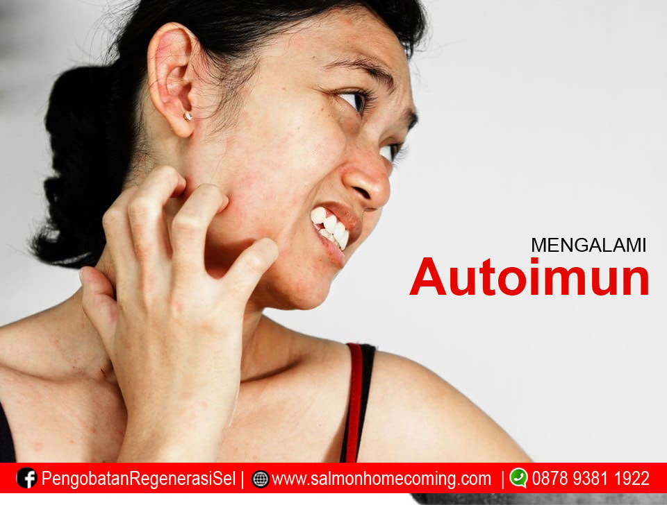 Pengobatan Alternatif Untuk Penyakit Autoimun Yang Efektif